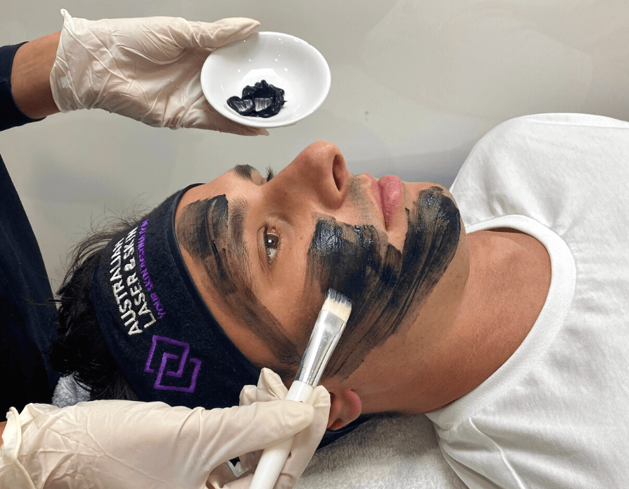 NEEDLING-DEV Image from Australian Laser & Skin
