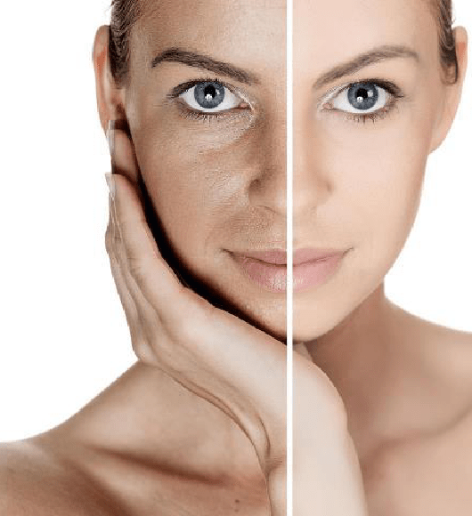 Dehydrated Skin