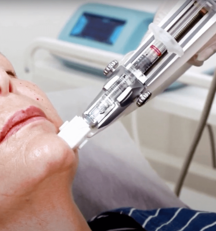 cosmelan-16 (1) Image from Australian Laser & Skin