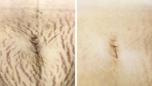 logo Image from Australian Laser & Skin