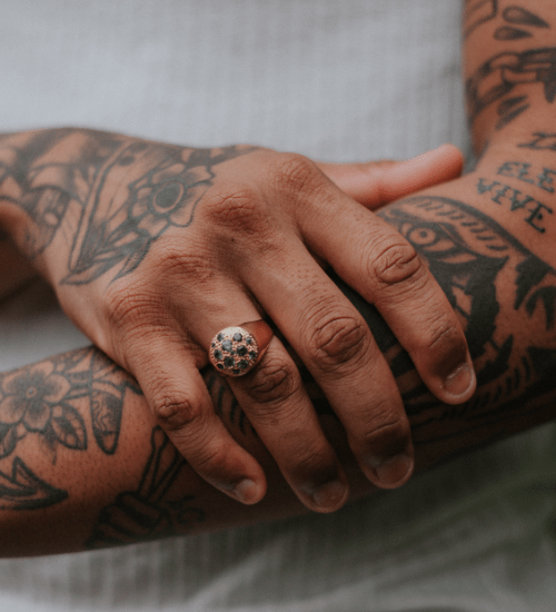 Aesthetic Concern Unwanted Tattoos