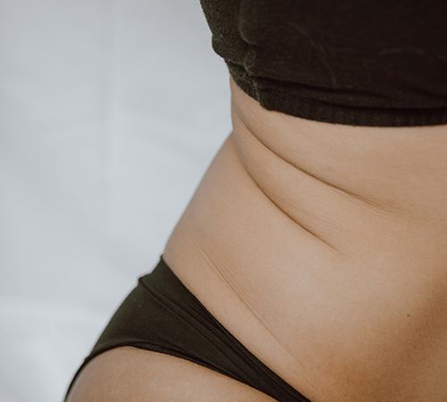 Stubborn Fat